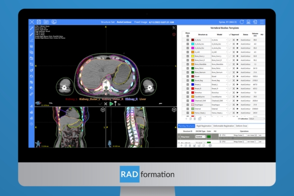 Screen shot of the AutoContour software